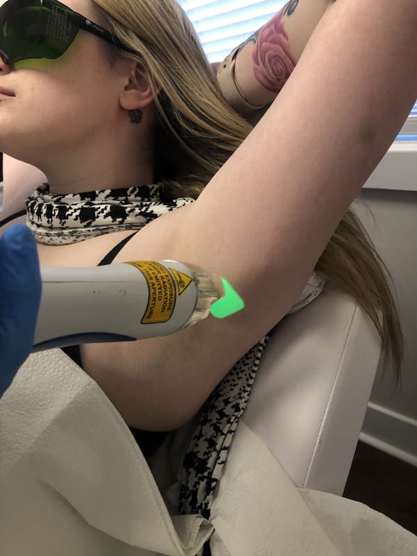 1755896060_lhr-2 Laser Hair Removal Morris County NJ