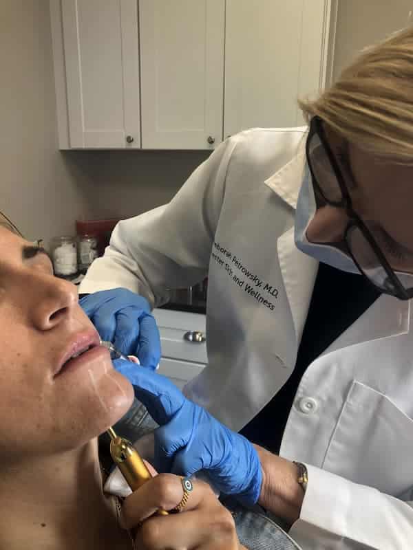 1755897418_juvederm-2